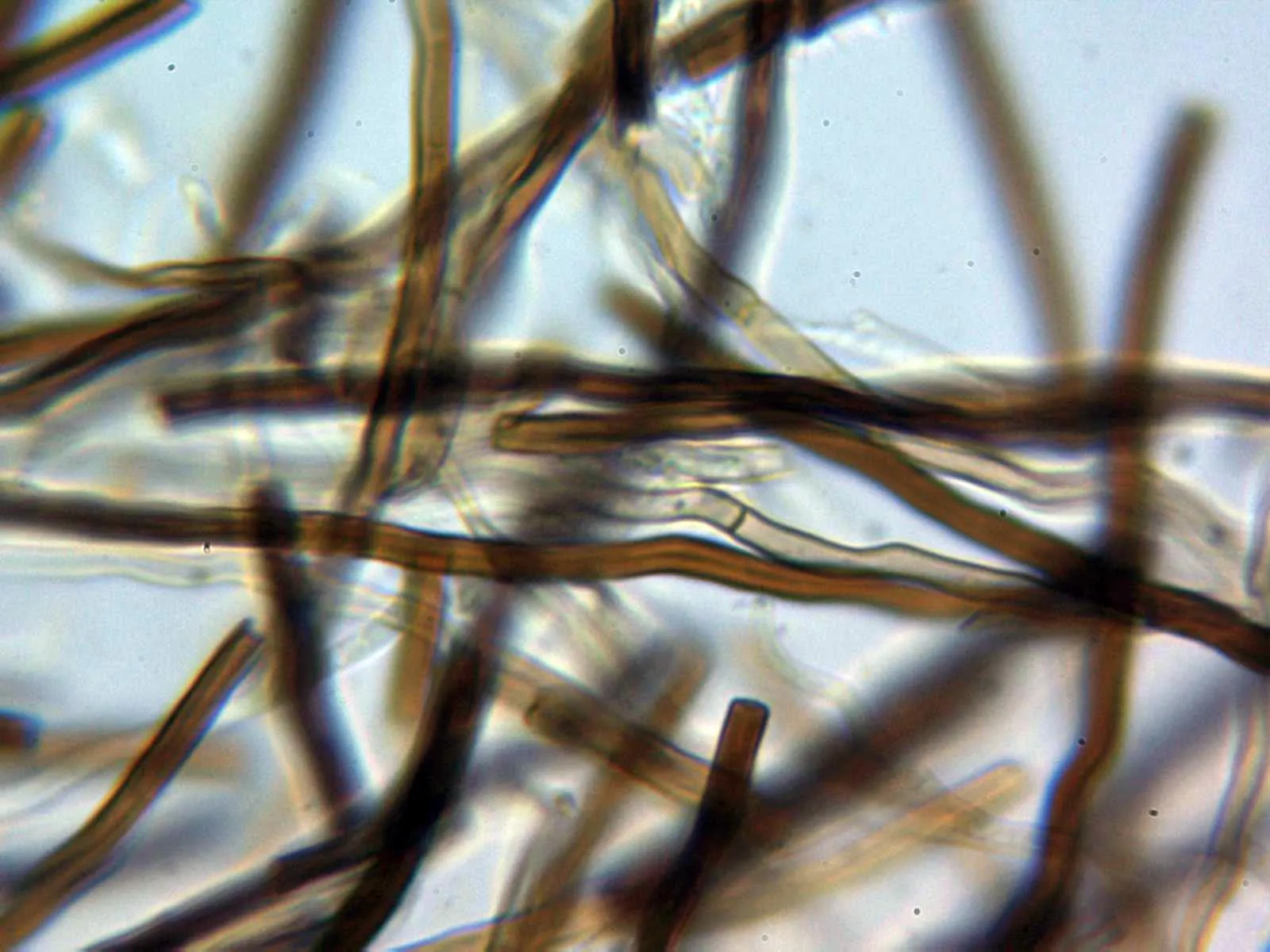 Microscopía de Porodaedalea pini - 10 - Hifas generativas pocas
